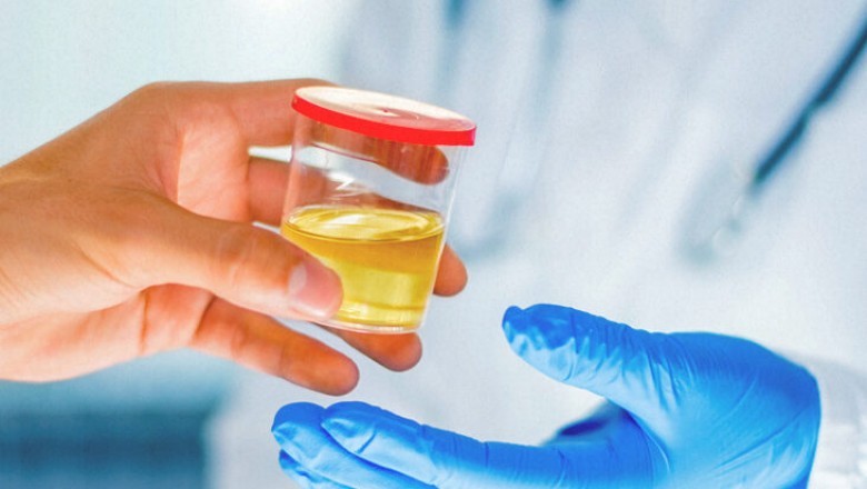 6 Panel Urine Drug Test | CLIA Waived | FDA Approved