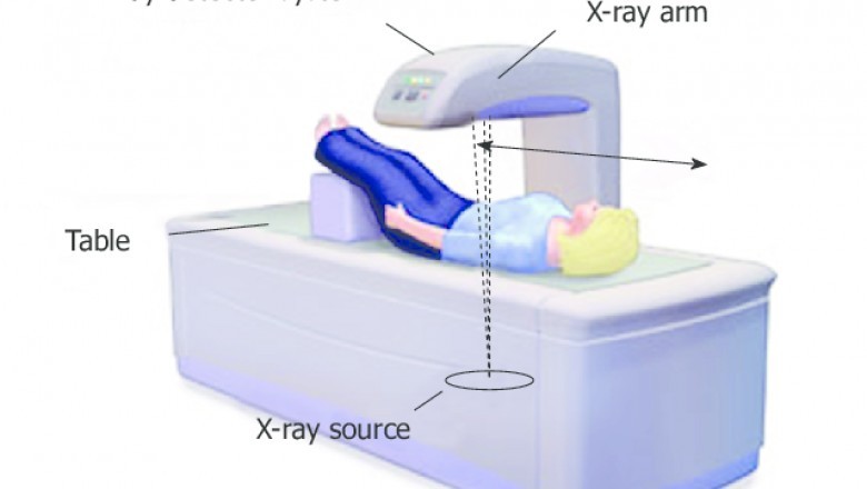 Bone Densitometer Devices Market Latest Innovations, Drivers and Industry Status 2021 to 2028 | GE, Swissray, KITA