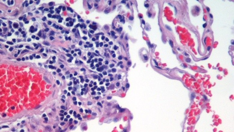 Histology & Cytology Market Global Industry Analysis, Size, Share, Growth, Trends, and Forecast, 2020-2030