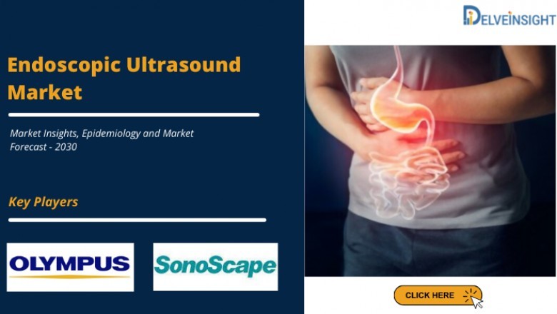 What is Endoscopic Ultrasound?