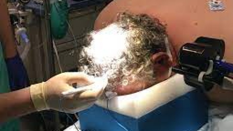 Neuro-navigation Systems Market | Segment-wise, Country-wise, and Region-wise Analysis