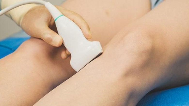 Does spider vein removal hurt?