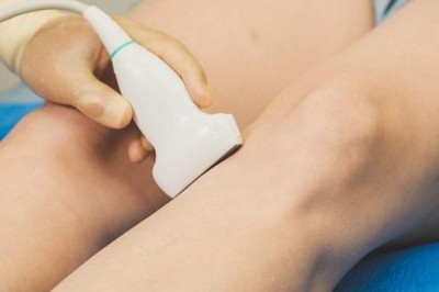 Does spider vein removal hurt?