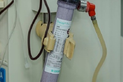 You Should Experience Blood Dialyzer At Least Once In Your Lifetime And Here's Why.