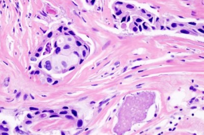 Anatomic Pathology is a branch of medicine that is mainly concerned with the diagnosis of an ailment