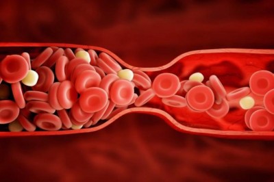 Blood Clotting Factors are involved in blood clotting and are responsible for several other health problems and difficulties as well