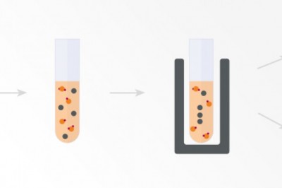Cell Separation Technology Market 2021: Company Profiles, Trends, Industry Growth, Segments, Landscape and Demand by Forecast to 2028