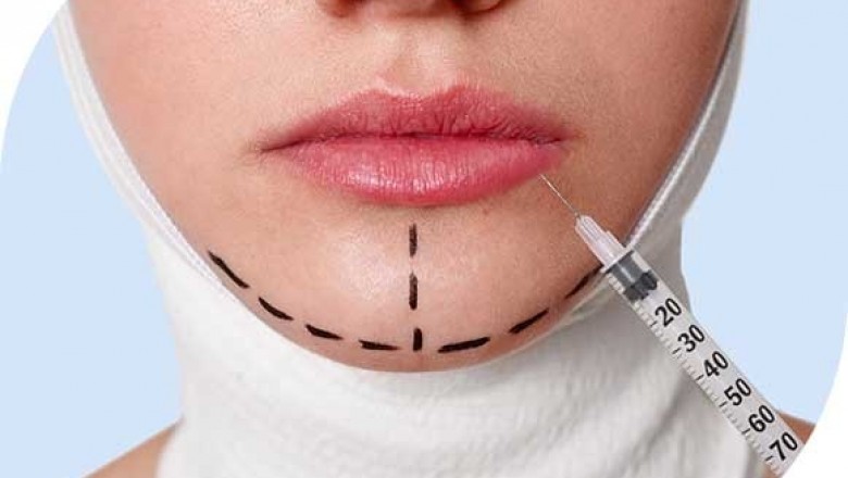 Thread Face Lift Cost In Bangalore