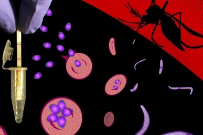 Global Malaria Diagnostics Treatment Market Detail Analysis focusing on Key Players | Forecasts 2021-2028