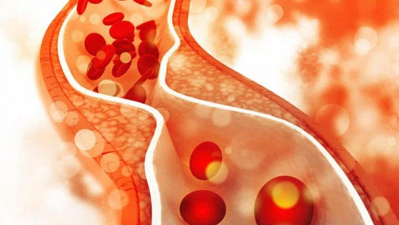 Coastal Vascular Center - Vascular Clinic