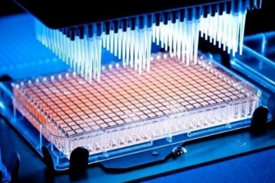 Global High Throughput Screening Market SWOT Analysis, Key Indicators and Forecast To 2028