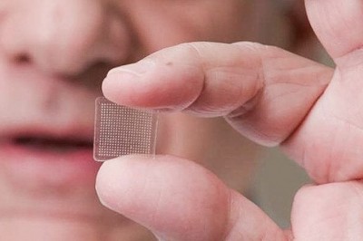 Global Microneedle Market Report 2020 - Market Size, Share, Price, Trend and Forecastv