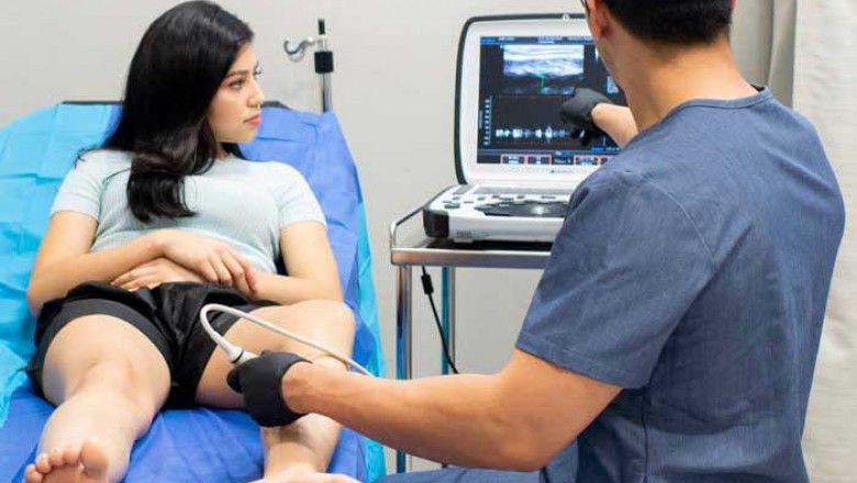 A Complete Guide to the Spider Vein Treatment