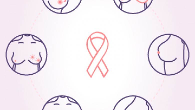 Breast Cancer Causes and Prevention | Breast Lump Causes | Dr. Deepak Jha