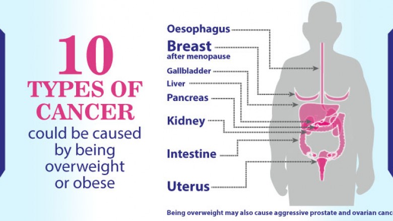 Obesity and Cancer Treatment in Delhi | Dr. Priya Tiwari