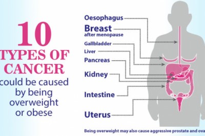 Obesity and Cancer Treatment in Delhi | Dr. Priya Tiwari