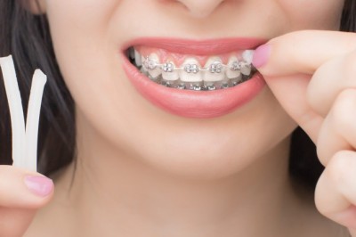 Orthodontic Supplies used to keep children straight and healthy teeth for a longer period of time include orthodontic bands, orthodontic headgear and orthodontic headboards