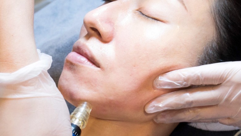 Dermaplaning Treatment: How To Get Fresh Looking Skin?