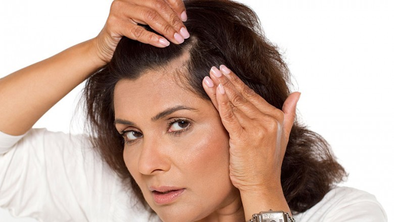 In just a few steps, a detailed guide to hair transplantation for women