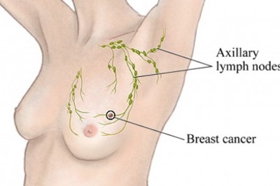 Breast Biopsy Market  Expected to Showcase Extensive Growth, Business Opportunity | Industry Analysis | Johnson & Johnson, Galini SRL, Intact Medical Corporation, Conceptus INC, Hologic Inc., Karl Storz GmbH & Co. Kg, and GE 
