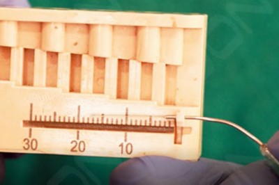 PHOTOACTIVATED DISINFECTION (PAD) FOR ROOT CANAL DISINFECTION USING LASER