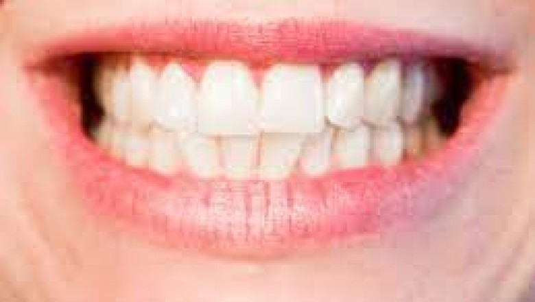 About teeth grinding