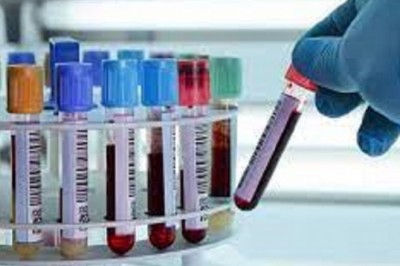 Heavy Metal Testing Market research by dbmr forecast to 2027
