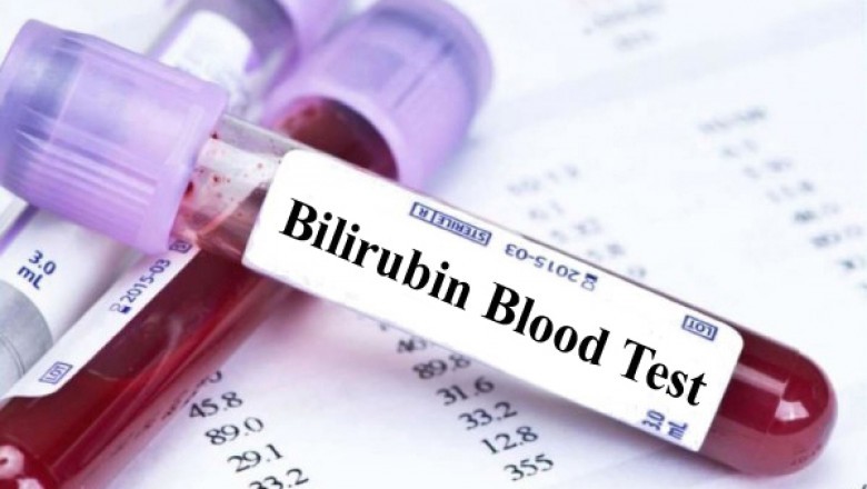 Bilirubin Blood Test Market Growth Latest Analysis Report, Post Covid Growth Projection, High CAGR 5.44% to 2027