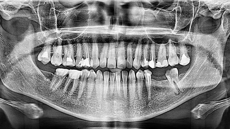 Global Dental Radiology and Dental Imaging Devices Market Business Opportunities, Current Trends And Industry Analysis By 2027