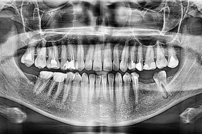 Global Dental Radiology and Dental Imaging Devices Market Business Opportunities, Current Trends And Industry Analysis By 2027