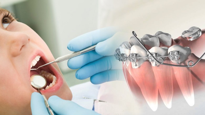 What Are the Treatment Services Offered By the Best Orthodontist Bensonhurst?