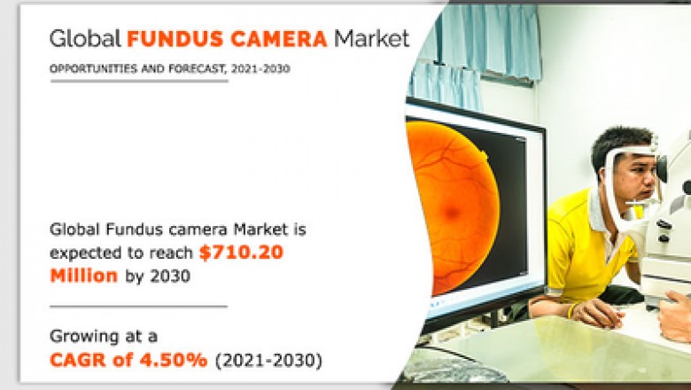 Fundus Camera Market Registering a Strong Growth by 2030