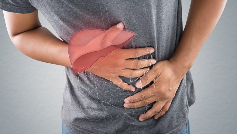 Herbs For Fatty Liver - Herbal Medicine For Liver Disease