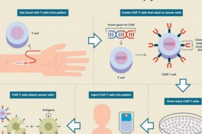 The Global CAR-T Cell Therapy Market is expected to be valued at US$ 7.7 Billion by 2028