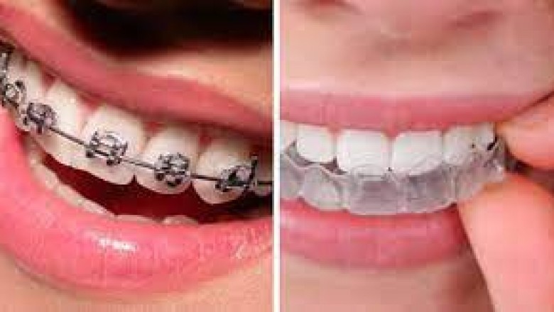 Your BACK AGAIN TO School Dental Care Guide