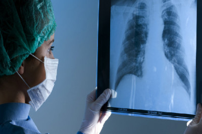 X-ray detectors have revolutionized the way cancer is diagnosed