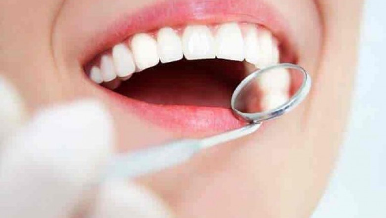 Best Dental Implants Near Me