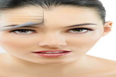 Best Botox in London