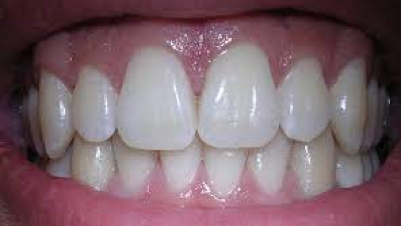 Tooth decay and gum illness