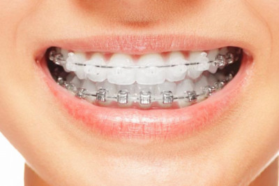 Best Orthodontist Office In North Miami