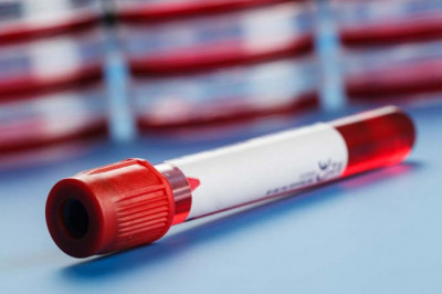 The purpose of the blood coagulation tubes is to collect blood samples for studying the amount of coagulation in the blood of the human body.