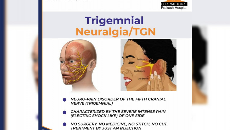 All you need to know about Trigeminal Neuralgia (TGN)