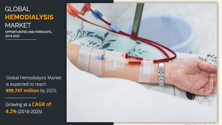 Hemodialysis Market To Make Great Impact In Near Future By 2025