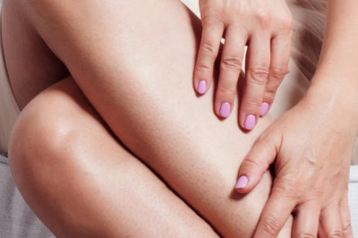 What are the superfoods for Varicose Veins? Check here