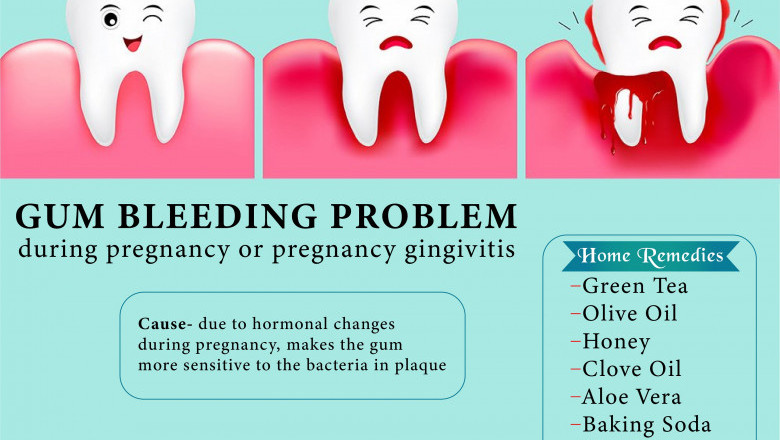 Gum Bleeding Problem | Emergency Dental Services