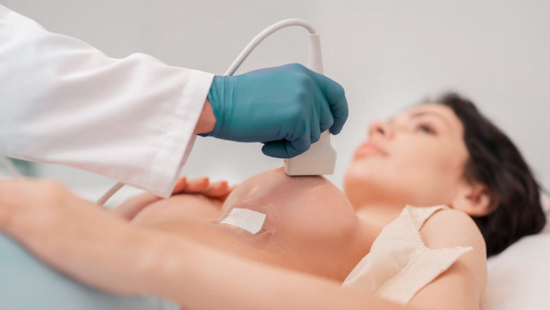 Breast Imaging Market Trends, Strategies, Potential Growth and Demand Analysis Forecast to 2027