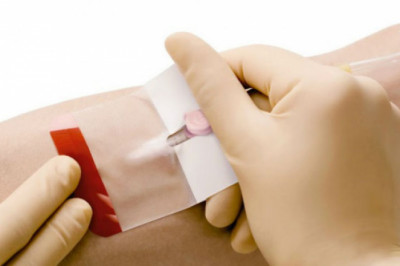 Peripheral Intravenous Catheter Market Intelligence Study For Comprehensive Insights