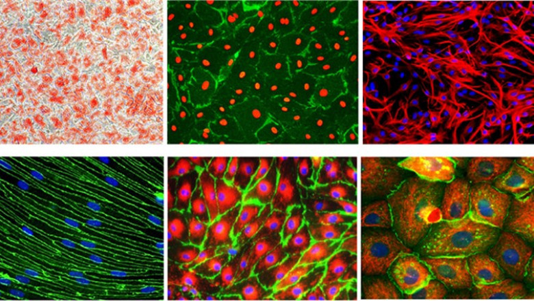 Zinc Manganese Dry Cell Market Report | Global Forecast To 2028