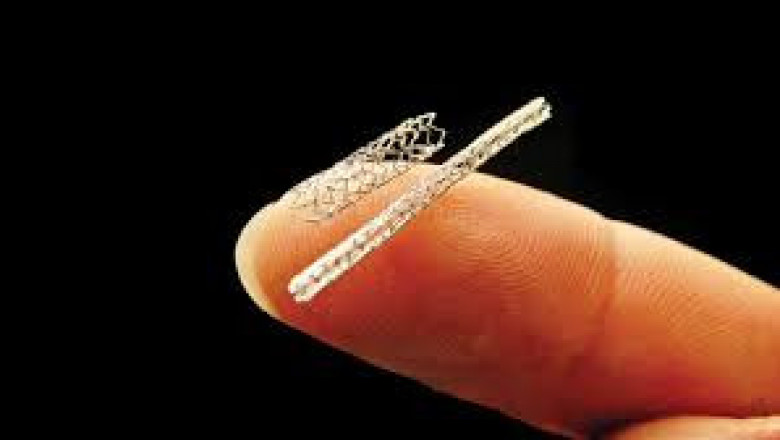 Coronary Stents Market Share to Witness Steady Rise in the Coming Decade