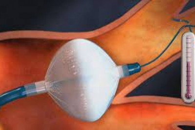 Cryoablation Devices Market Research Report, Size, Share and Forecast